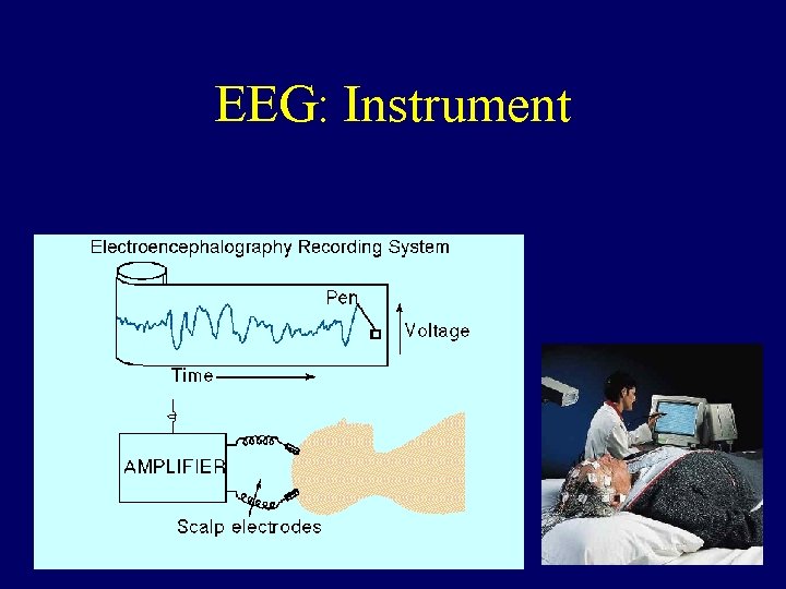 EEG: Instrument 