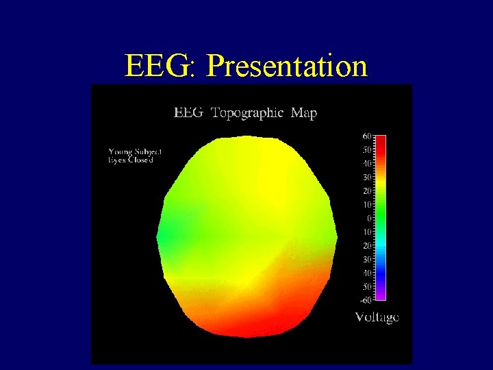 EEG: Presentation 