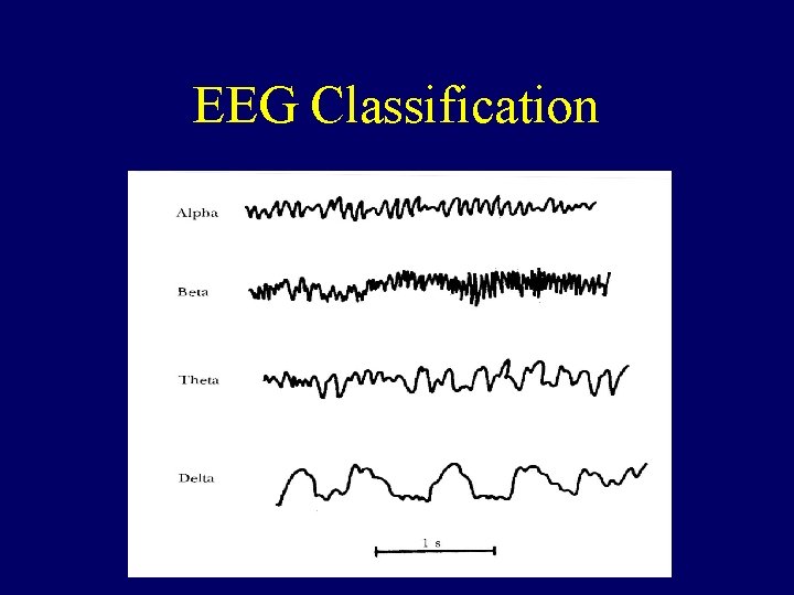 EEG Classification 