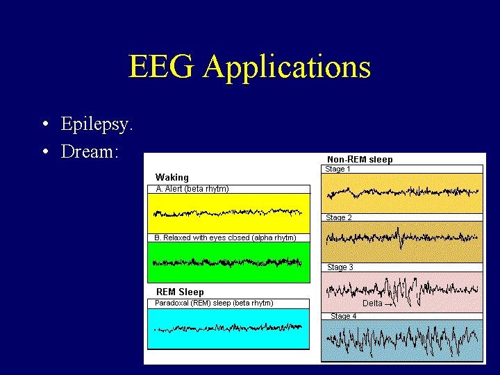 EEG Applications • Epilepsy. • Dream: 