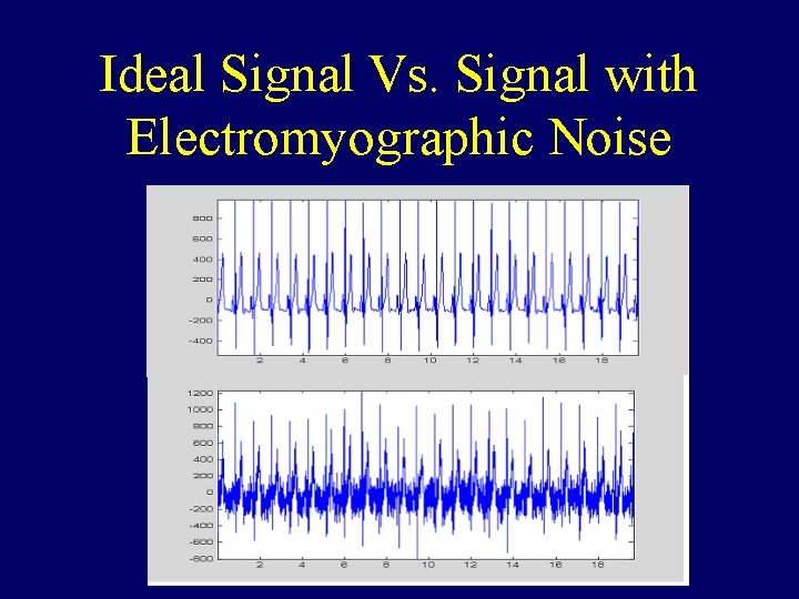 Ideal Signal Vs. Signal with Electromyographic Noise 