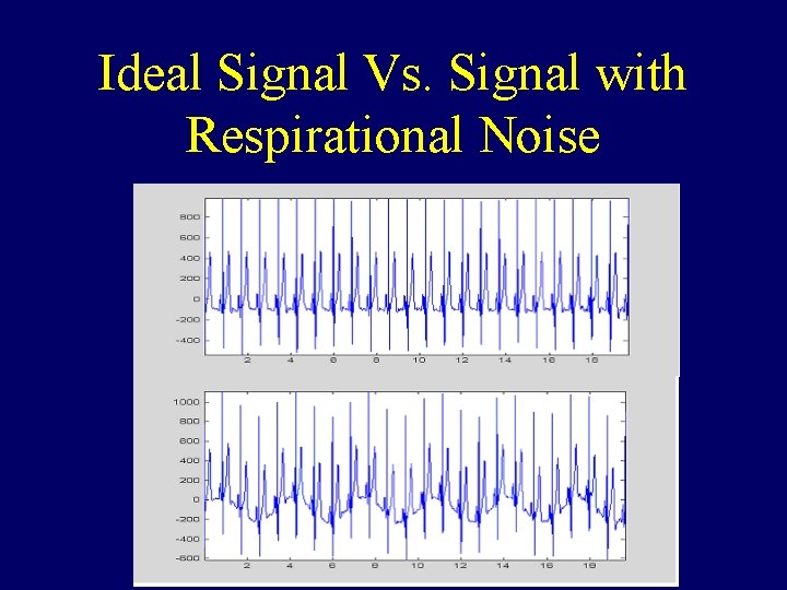 Ideal Signal Vs. Signal with Respirational Noise 
