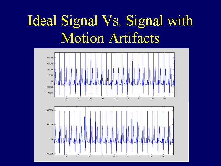 Ideal Signal Vs. Signal with Motion Artifacts 