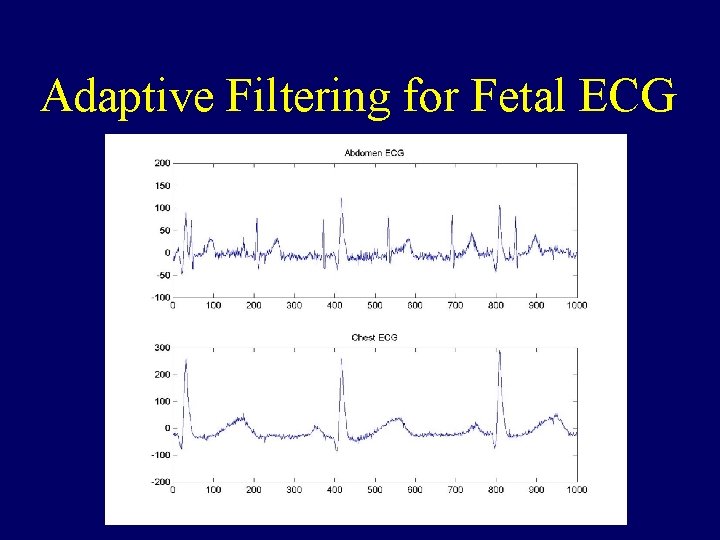 Adaptive Filtering for Fetal ECG 