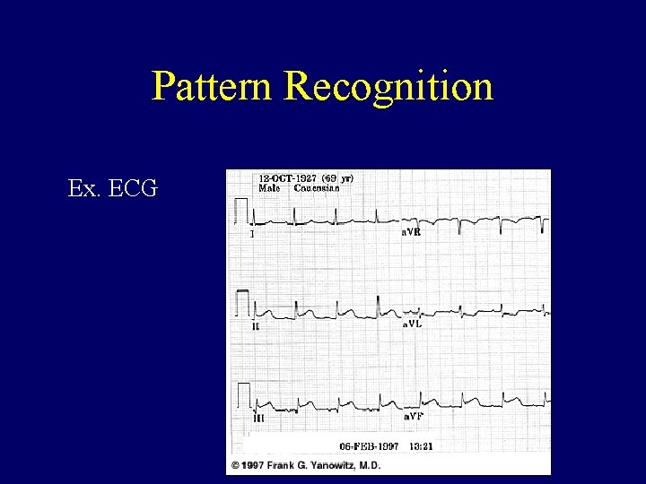 Pattern Recognition Ex. ECG 