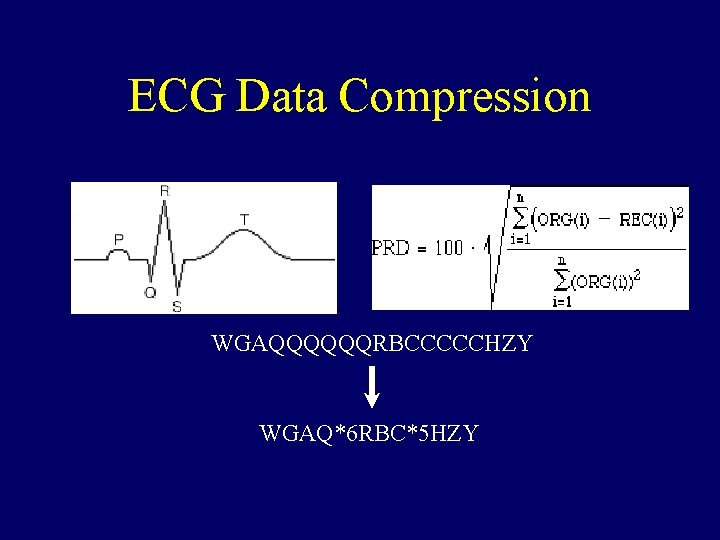 ECG Data Compression WGAQQQQQQRBCCCCCHZY WGAQ*6 RBC*5 HZY 