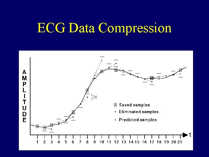 ECG Data Compression 