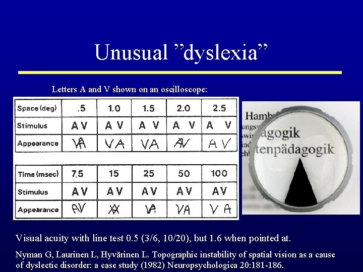 Unusual ”dyslexia” Letters A and V shown on an oscilloscope: Visual acuity with line