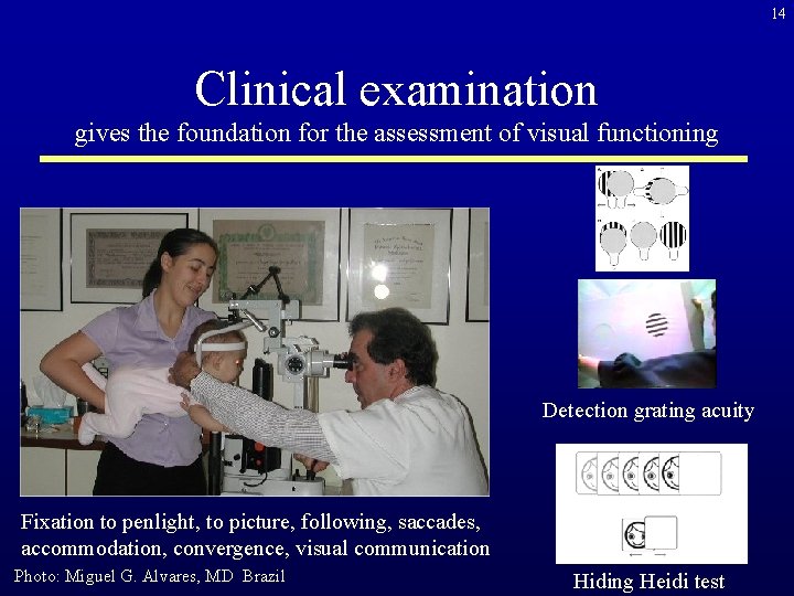 14 Clinical examination gives the foundation for the assessment of visual functioning Detection grating