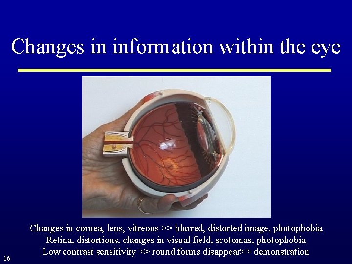 Changes in information within the eye 16 Changes in cornea, lens, vitreous >> blurred,