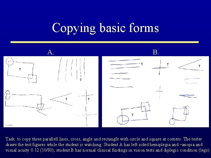 Copying basic forms A. B. T T Task: to copy three parallell lines, cross,