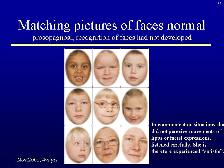 31 Matching pictures of faces normal prosopagnosi, recognition of faces had not developed In