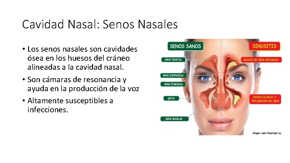 Cavidad Nasal: Senos Nasales • Los senos nasales son cavidades ósea en los huesos