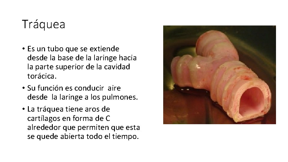 Tráquea • Es un tubo que se extiende desde la base de la laringe
