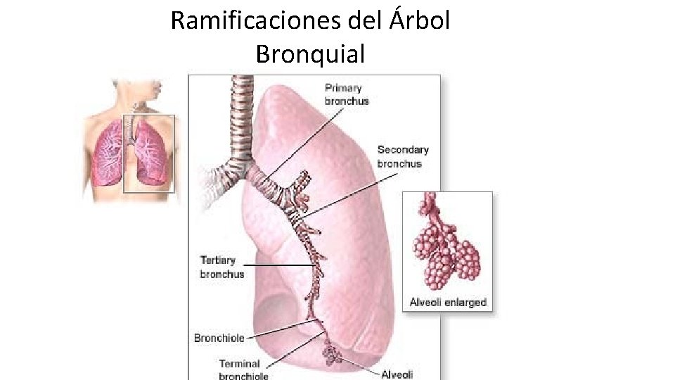 Ramificaciones del Árbol Bronquial 