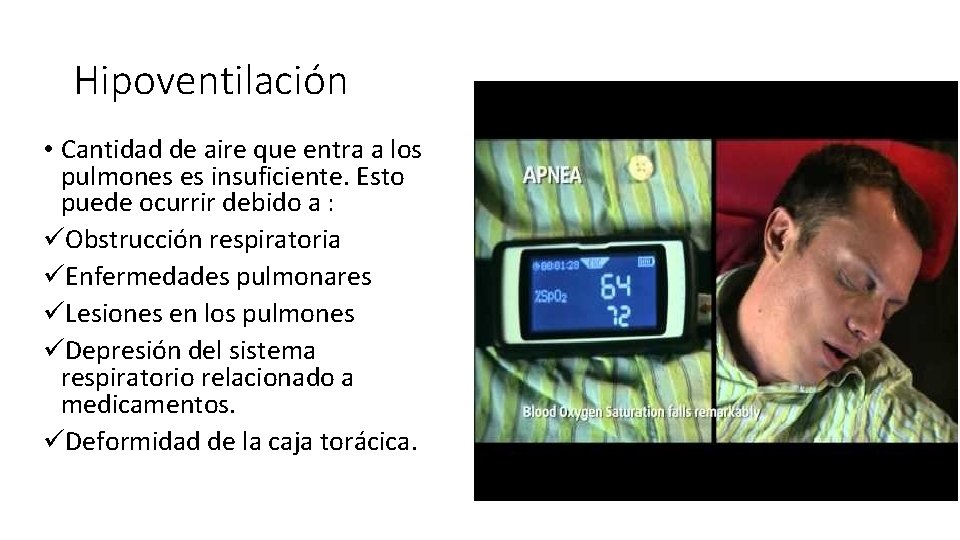 Hipoventilación • Cantidad de aire que entra a los pulmones es insuficiente. Esto puede