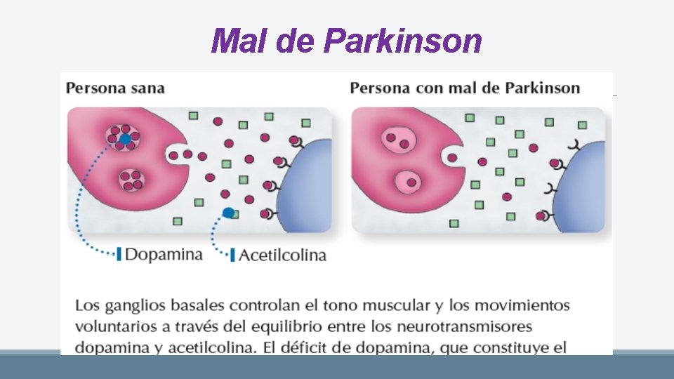 Mal de Parkinson 