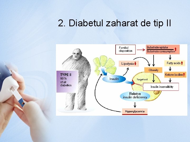 2. Diabetul zaharat de tip II 