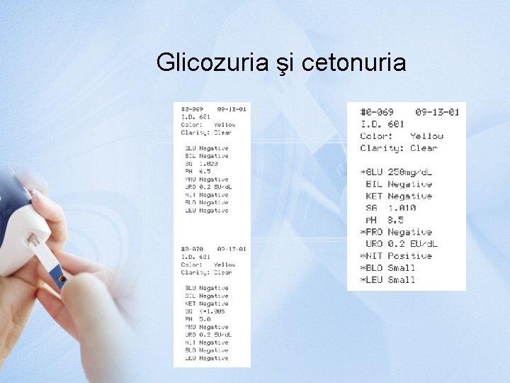 Glicozuria şi cetonuria 