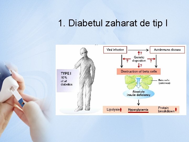 1. Diabetul zaharat de tip I 