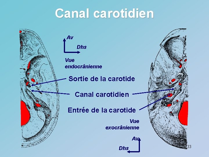 Canal carotidien Av Dhs Vue endocrânienne Sortie de la carotide Canal carotidien Entrée de
