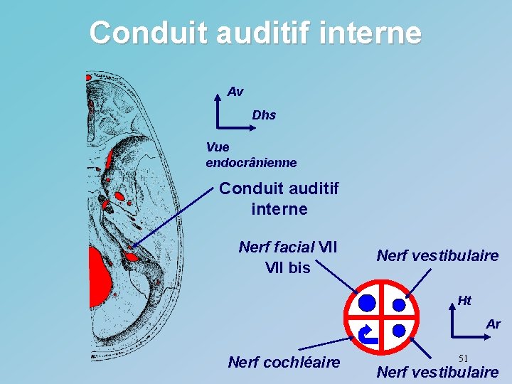 Conduit auditif interne Av Dhs Vue endocrânienne Conduit auditif interne Nerf facial VII bis