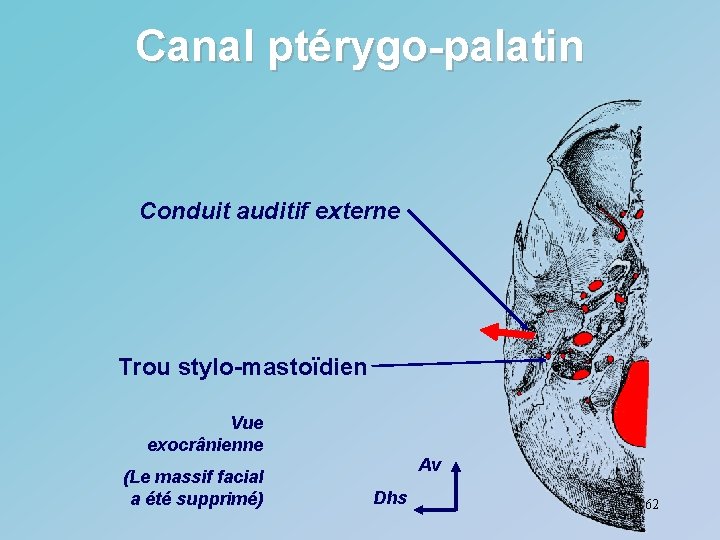 Canal ptérygo-palatin Conduit auditif externe Trou stylo-mastoïdien Vue exocrânienne (Le massif facial a été