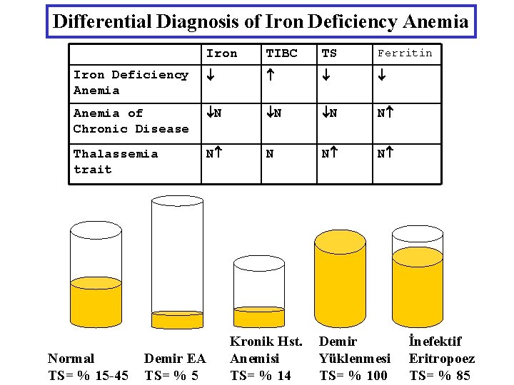 Differential Diagnosis of Iron Deficiency Anemia Iron TIBC TS Ferritin Iron Deficiency Anemia of