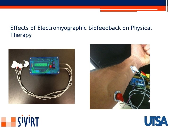 Effects of Electromyographic biofeedback on Physical Therapy 