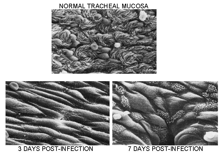 NORMAL TRACHEAL MUCOSA 3 DAYS POST-INFECTION 7 DAYS POST-INFECTION 