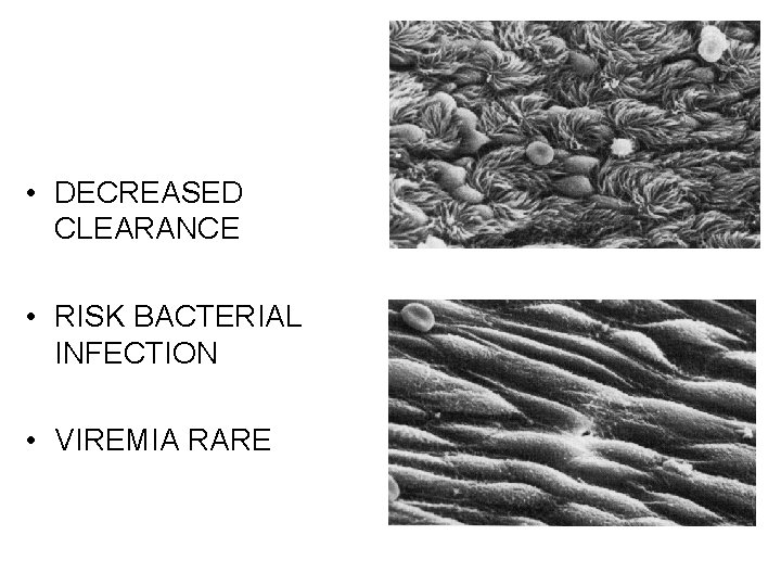  • DECREASED CLEARANCE • RISK BACTERIAL INFECTION • VIREMIA RARE 