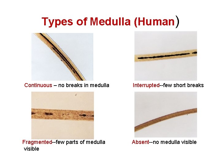 Types of Medulla (Human) Continuous – no breaks in medulla Fragmented--few parts of medulla