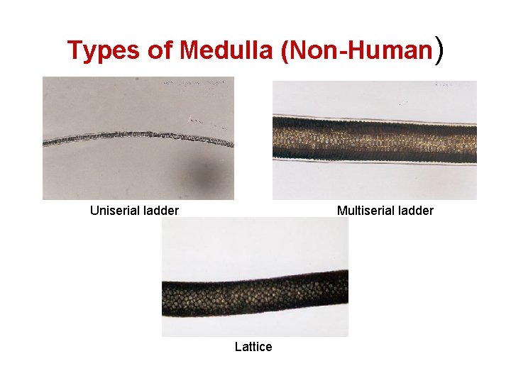 Types of Medulla (Non-Human) Uniserial ladder Multiserial ladder Lattice 