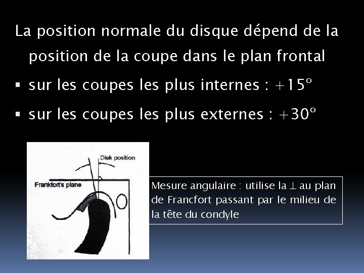 La position normale du disque dépend de la position de la coupe dans le