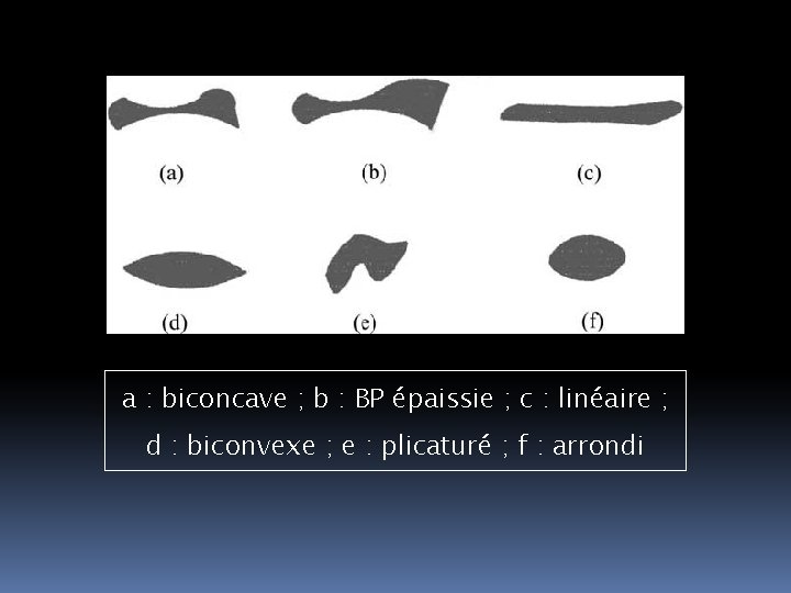 a : biconcave ; b : BP épaissie ; c : linéaire ; d