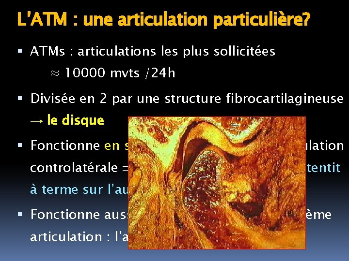 L’ATM : une articulation particulière? ATMs : articulations les plus sollicitées ≈ 10000 mvts