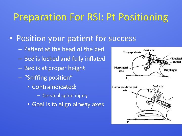 Preparation For RSI: Pt Positioning • Position your patient for success – Patient at