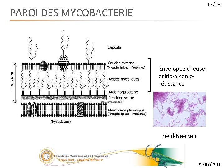 13/23 PAROI DES MYCOBACTERIE Enveloppe cireuse acido-alcoolorésistance Ziehl-Neelsen 05/09/2016 