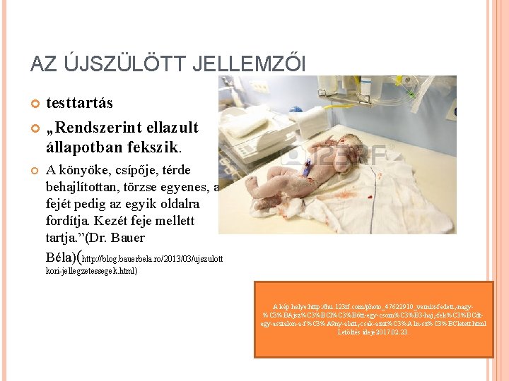 AZ ÚJSZÜLÖTT JELLEMZŐI testtartás „Rendszerint ellazult állapotban fekszik. A könyöke, csípője, térde behajlítottan, törzse AZ ÚJSZÜLÖTT JELLEMZŐI testtartás „Rendszerint ellazult állapotban fekszik. A könyöke, csípője, térde behajlítottan, törzse