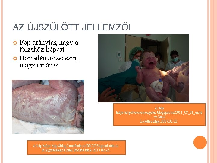 AZ ÚJSZÜLÖTT JELLEMZŐI Fej: aránylag nagy a törzshöz képest Bőr: élénkrózsaszín, magzatmázas A kép AZ ÚJSZÜLÖTT JELLEMZŐI Fej: aránylag nagy a törzshöz képest Bőr: élénkrózsaszín, magzatmázas A kép