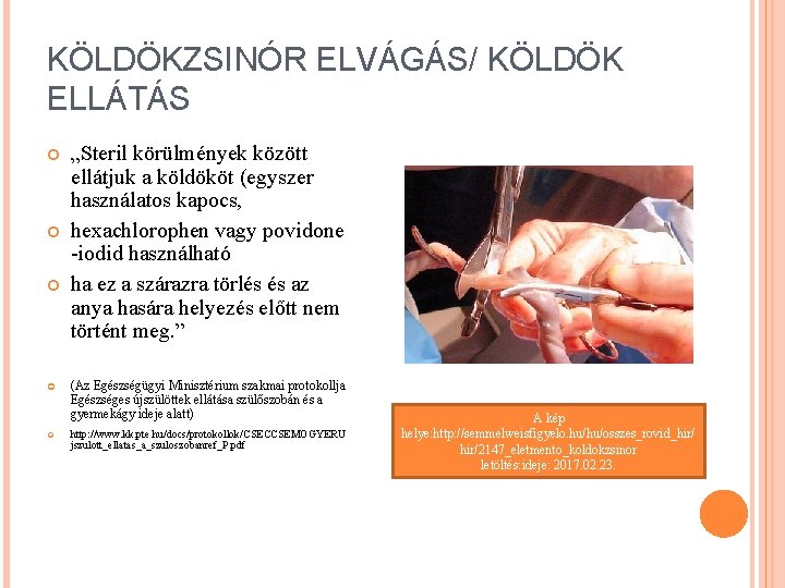 KÖLDÖKZSINÓR ELVÁGÁS/ KÖLDÖK ELLÁTÁS „Steril körülmények között ellátjuk a köldököt (egyszer használatos kapocs, hexachlorophen KÖLDÖKZSINÓR ELVÁGÁS/ KÖLDÖK ELLÁTÁS „Steril körülmények között ellátjuk a köldököt (egyszer használatos kapocs, hexachlorophen