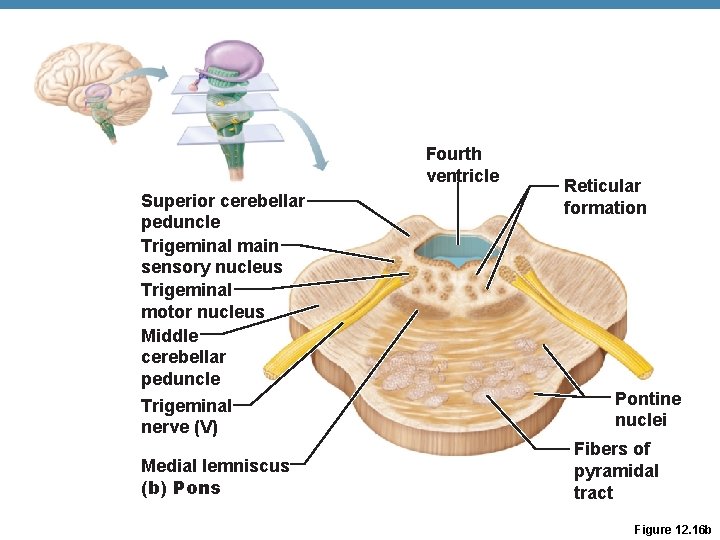 Fourth ventricle Superior cerebellar peduncle Trigeminal main sensory nucleus Trigeminal motor nucleus Middle cerebellar