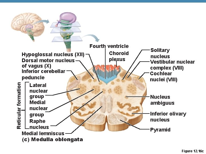 Reticular formation Fourth ventricle Choroid Hypoglossal nucleus (XII) plexus Dorsal motor nucleus of vagus