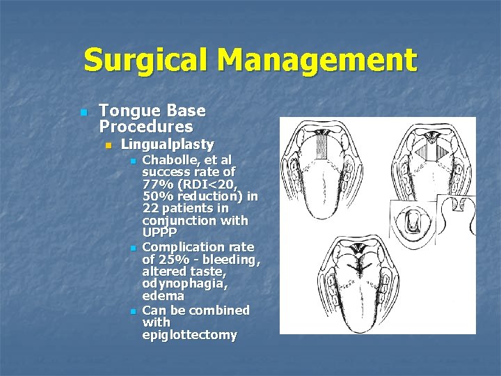 Surgical Management n Tongue Base Procedures n Lingualplasty n n n Chabolle, et al