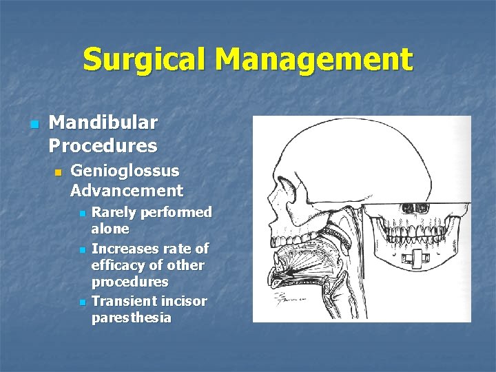 Surgical Management n Mandibular Procedures n Genioglossus Advancement n n n Rarely performed alone