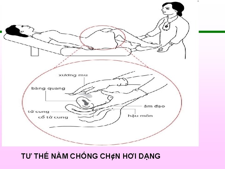 TƯ THẾ NẰM CHỐNG CH¢N HƠI DẠNG 