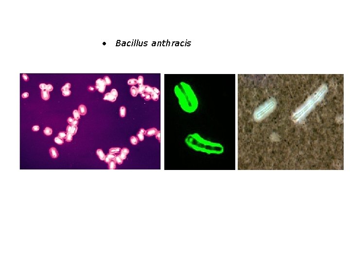  • Bacillus anthracis 