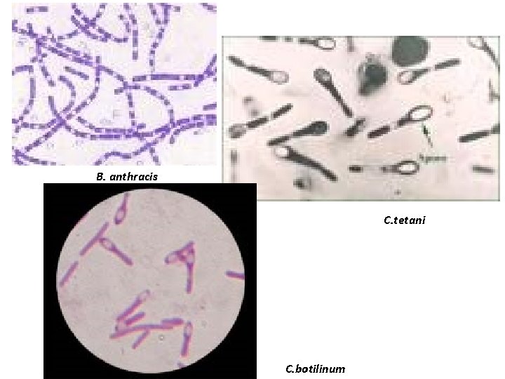 B. anthracis C. tetani C. botilinum 