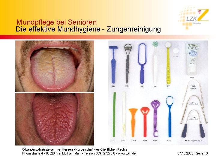 Mundpflege bei Senioren Die effektive Mundhygiene - Zungenreinigung © Landeszahnärztekammer Hessen • Körperschaft des