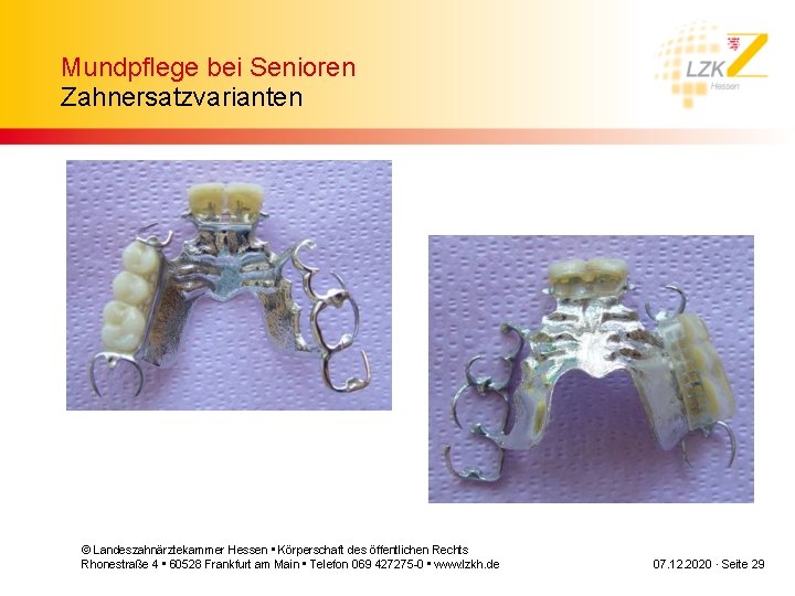 Mundpflege bei Senioren Zahnersatzvarianten © Landeszahnärztekammer Hessen • Körperschaft des öffentlichen Rechts Rhonestraße 4